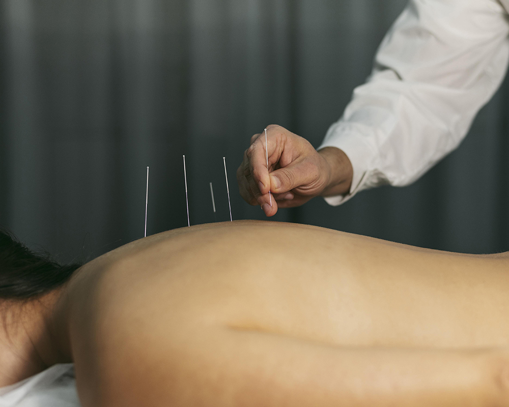 Healthy Habits - Acupuncture